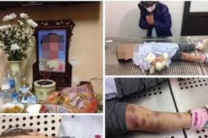 Bé gái 3 tuổi tử vong nghi bị cha mẹ bạo hành
