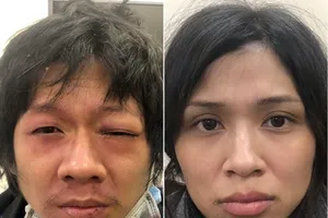 Bắt giam người mẹ hành hạ con gái 3 tuổi đến tử vong