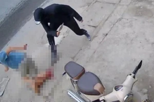 Bắt giữ nghi can trong vụ chém lìa cẳng chân nạn nhân