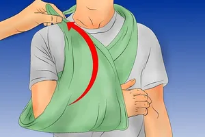 Kinh nghiệm sơ cứu cho người bị tai nạn giao thông