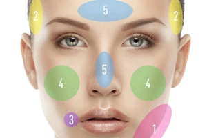 Đoán bệnh qua vị trí mụn mọc trên mặt