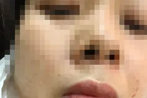 Xử phạt 6,5 triệu đồng với Phó công an xã đánh vợ cũ