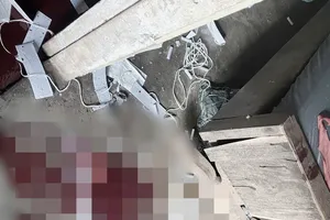 1 nam sinh bị nát bàn tay do nổ pháo tự chế