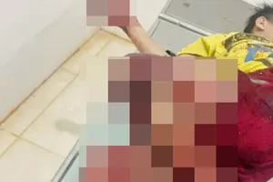 Gia Lai: 4 học sinh nhập viện cấp cứu do chế tạo pháo phát nổ