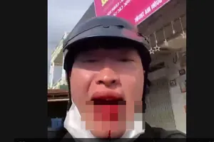 Người đàn ông chặn xe đánh người, hỏi: 'Mày biết tao là ai không?'