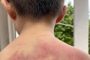 Bé trai 5 tuổi ở Đồng Nai bị cha ruột đánh dã man