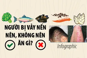 Người bị vảy nến nên, không nên ăn gì?