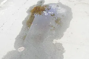 Nạn nhân bị truy sát ở Thanh Đa đã qua cơn nguy kịch