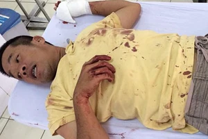 Sẽ làm rõ vụ “chém người trước mặt công an” ở Bình Thạnh (TP.HCM)