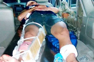 Đề nghị truy tố nghi can đánh gãy chân bạn của con gái