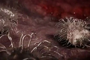 Tử vong vì vi khuẩn “ăn thịt người”