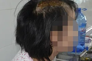 Đòi công lý và an toàn cho cháu bị chém