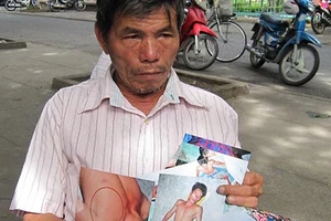 Nghi trộm, một người bị công an đánh