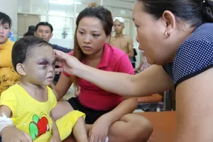 Hai vợ chồng đánh dã man bé gái bốn tuổi