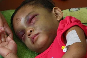 Cuộc sống “địa ngục” của bé gái bốn tuổi 