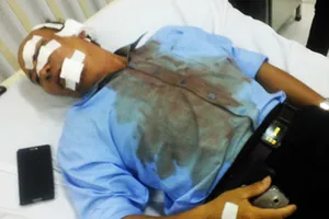 Hạt trưởng Quản lý đường bộ 73.4 bị đánh