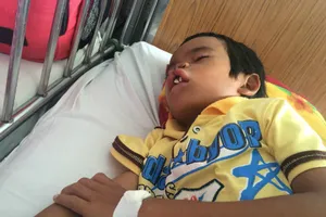 Cậu bé 'Đằng sau nụ cười' hồi phục tốt sau mổ