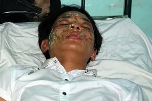 Đi chơi Noel, ba học sinh nhập viện do bình gas mini phát nổ