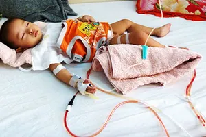 Tái tạo bàng quang cho bé bị cắt nhầm