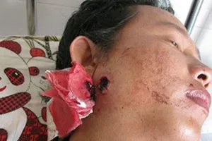 Vụ 'người bị bắn được tuyên trắng án': VKS kháng nghị theo hướng có tội