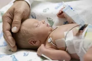 Lần đầu gây mê, gây tê trong phẫu thuật cho trẻ sinh non