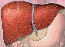 Kỹ thuật mới chẩn đoán xơ gan nhanh