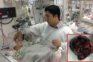 Vừa sinh ra đã mổ lấy u não