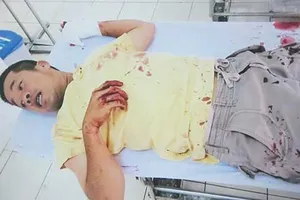 Chậm xử lý vụ đánh người trước mặt CSKV