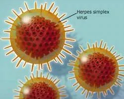 Phát sốt trước cuộc khủng hoảng siêu vi trùng