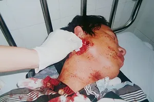 Hai lần được tuyên trắng án