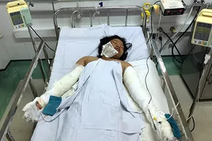 Bé gái bị mẹ đốt đang nguy kịch