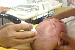 Bé bị dao xuyên não tái khám khỏe mạnh