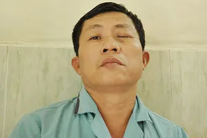 Một bệnh nhân múc bỏ mắt do nhiễm nấm