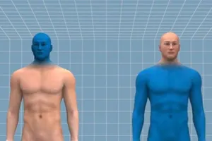 Việt Nam lên kế hoạch cho ca ghép đầu người