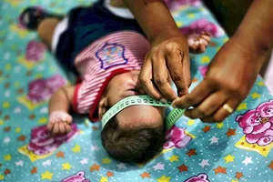 Nhiễm virus Zika qua đường tình dục