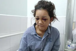 Thiếu úy công an bị tố đánh dập não người yêu