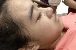 Nỗi sợ tật nguyền, chết oan