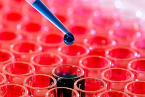 10 năm, hơn 200 ca ghép tế bào gốc thành công 