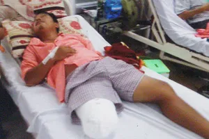 Từ ngã xe, một bệnh nhân đã bị cắt chân