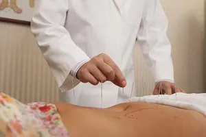 Châm cứu tốt cho trí nhớ