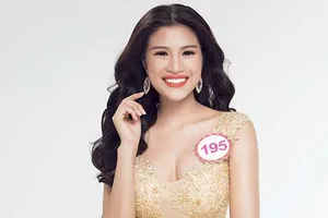 Sửa răng, không được thi hoa hậu