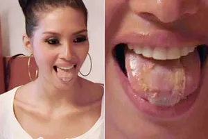 Hoa hậu ‘dao kéo’ cũng được, miễn nhìn cho ‘đã mắt’