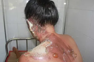 Những trận đòn từ ‘người đàn ông của cuộc đời’