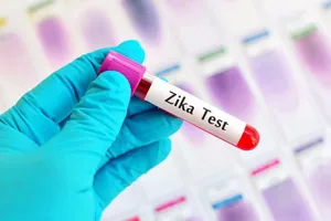TP.HCM có 38 người nhiễm virus Zika