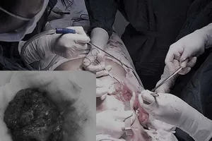 Phẫu thuật thẩm mỹ dỏm tung hoành làng quê