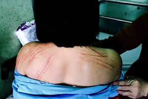 Nữ luật sư tố bị nguyên đơn đánh gãy 2 cái răng 