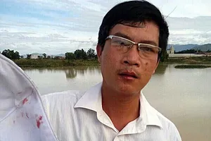 Bị kiểm tra, giám đốc đánh phó chủ tịch xã