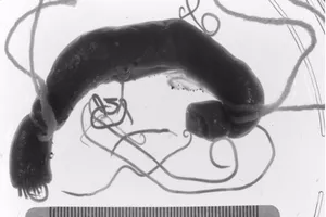 Coi chừng lây giun đũa chó từ thú cưng