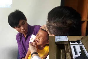 Hiểm họa bất ngờ từ súng bắn đạn bi 