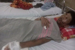 Bị hỏng mắt và bỏng nặng do pháo tự chế